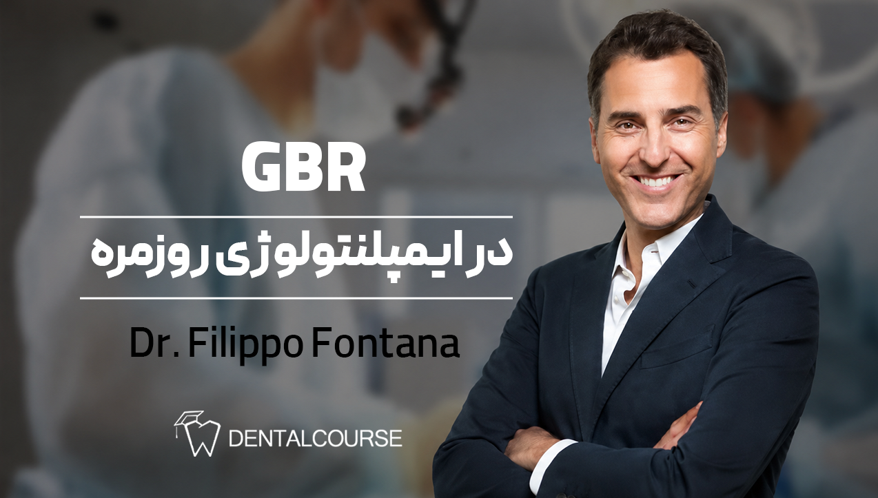GBR در ایمپلنتولوژی روزمره